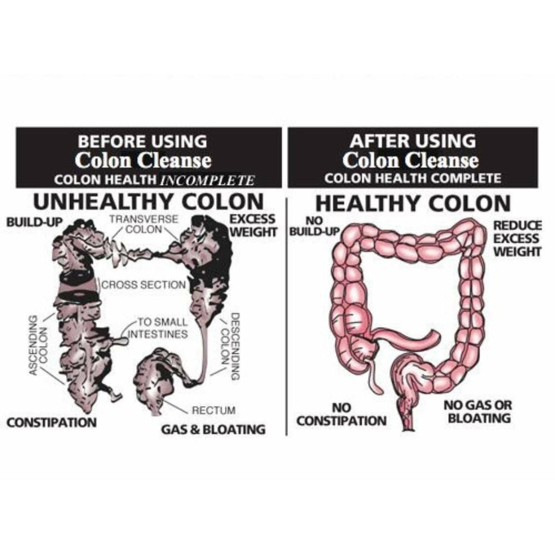 Mucoid Plaque/Colon Cleanse ( Two Weeks ) | NativeLifeLLC
